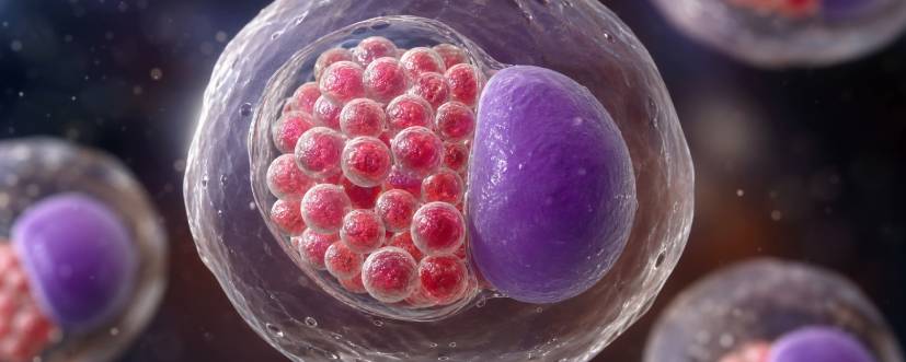 chlamydia