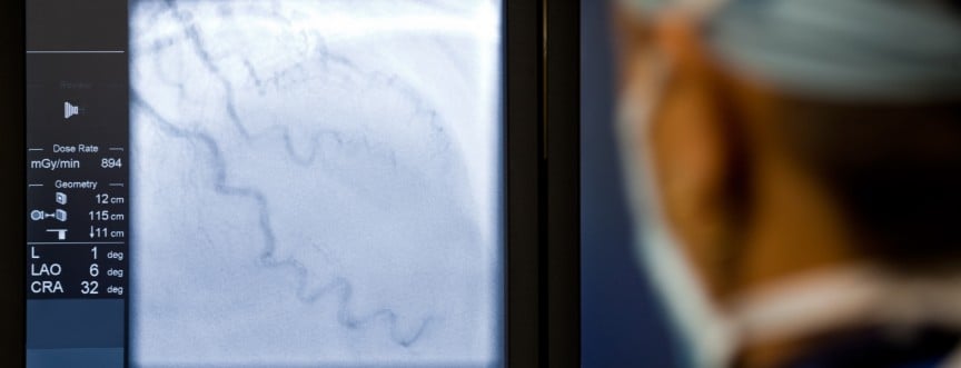 Angiografia. Na czym polega badanie radiologiczne naczyń?