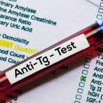 Anty-TG są produkowane w przebiegu chorób tarczycy o podłożu autoimmunologicznym.