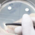 Antybiogram to badanie mikrobiologiczne, które ocenia wrażliwość bakterii na antybiotyki.
