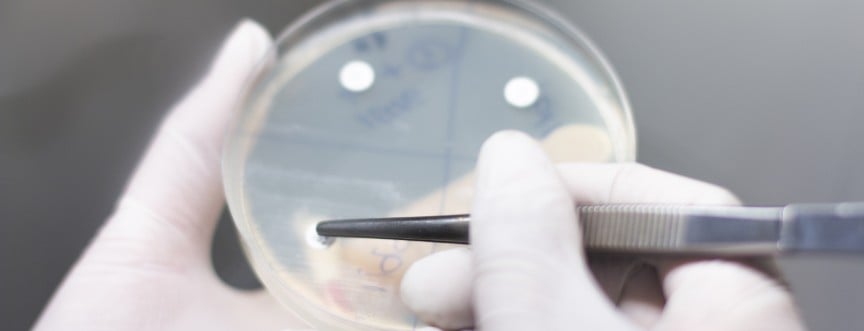 Antybiogram to badanie mikrobiologiczne, które ocenia wrażliwość bakterii na antybiotyki.