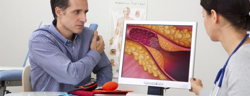 Cholesterol – norma, dobry i zły cholesterol (HDL, LDL), jak obniżyć poziom cholesterolu