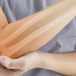 Choroby kości to m. in. osteoporoza.