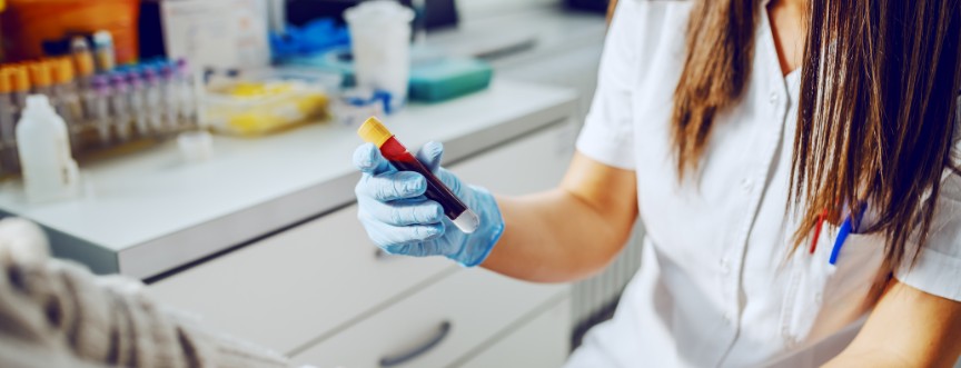 D-dimery – norma i wskazania do badania