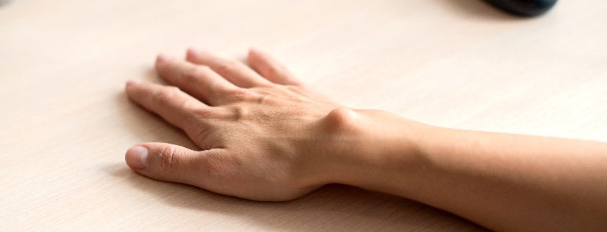 Ganglion jest twardym guzem zlokalizowanym w okolicy stawu.