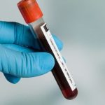 Globuliny pełnią funkcje odpornościowe, a także odpowiadają za transport kwasów tłuszczowych i hormonów.