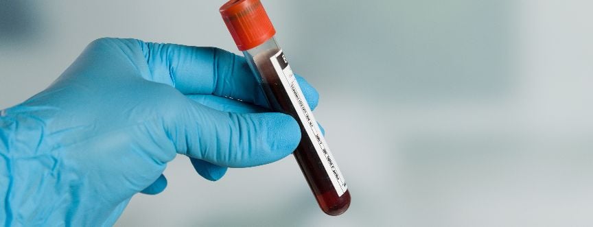 Globuliny – czym są i kiedy należy badać?