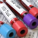 Nieleczone zakażenie HIV prowadzi do zespołu nabytego niedoboru odporności (AIDS).