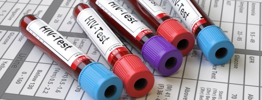 Nieleczone zakażenie HIV prowadzi do zespołu nabytego niedoboru odporności (AIDS).