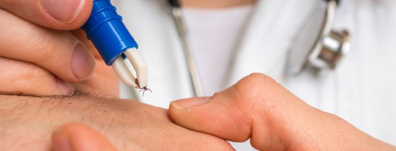 Jak bezpiecznie usunąć kleszcza? Instrukcja krok po kroku