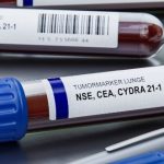 Markery nowotworowe to badania wykorzystywane w diagnostyce chorób onkologicznych.