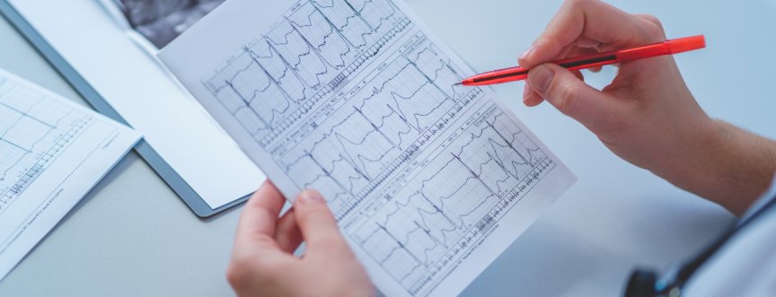Migotanie przedsionków – objawy, przyczyny, leczenie. Co to jest kardiowersja?