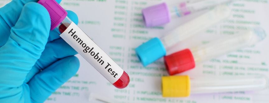 Niska hemoglobina – jakie są jej przyczyny? Co jeść, aby zwiększyć poziom hemoglobiny?