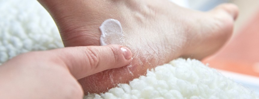 Pękające pięty – przyczyny. Jak sobie z tym radzić?