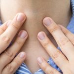 Najczęściej pierwszym objawem raka tarczycy jest guzek, który można wyczuć, badając tarczycę palcami.