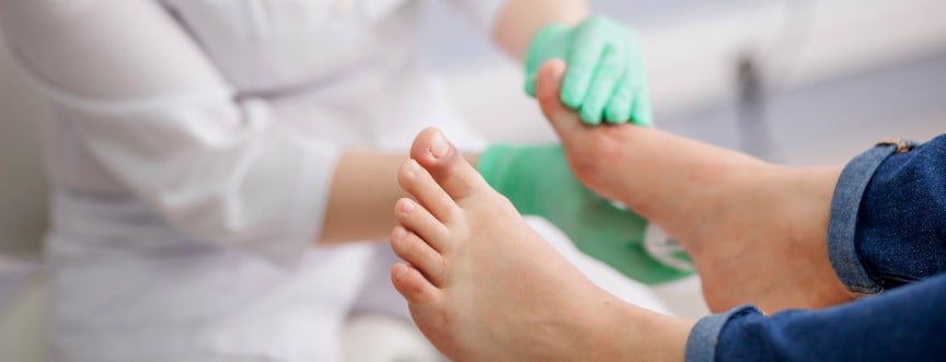 Stopa cukrzycowa – objawy, leczenie. Jak wygląda stopa cukrzycowa neuropatyczna i niedokrwienna