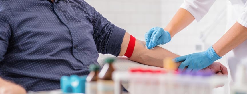 Test PSA (antygen prostaty) – jak działa? Jak interpretować wynik?