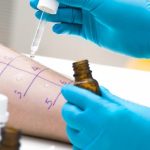 Testy alergiczne pozwalają ustalić, czy u pacjenta występuje alergia na określoną substancję.
