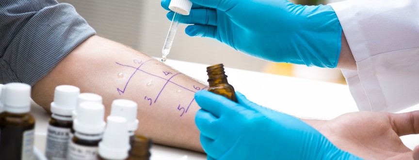 Testy alergiczne – skórne, z krwi, prowokacyjne. Kiedy wykonać?