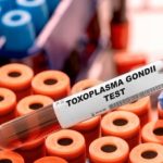 Toksoplazmoza stanowi szczególne zagrożenie dla kobiet w ciąży i osób z obniżoną odpornością.