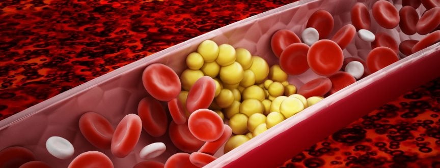 Trójglicerydy – normy. Jak obniżyć wysokie trójglicerydy?