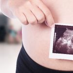 Każda kobieta w ciąży ma obowiązek wykonać przynajmniej 3 badania USG.