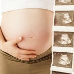 USG połówkowe wykonuje się miedzy 18. a 22. tygodniem ciąży.