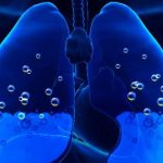 Woda w płucach wymaga dalszej diagnostyki. Problemu nie wolno bagatelizować.