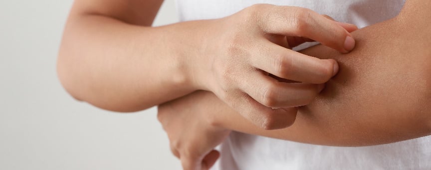Wysypka na ciele – przyczyny wysypki u dorosłych i dzieci