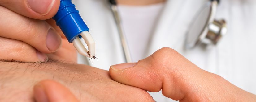 Babeszjoza – objawy, leczenie, diagnostyka / Fot. Adobe Stock