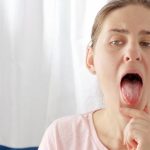 Plamki Koplika – jak wyglądają i o czym świadczą? / Fot. Adobe Stock