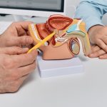 Zapalenie prostaty może mieć postać ostrą lub przewlekłą / Fot. Adobe Stock