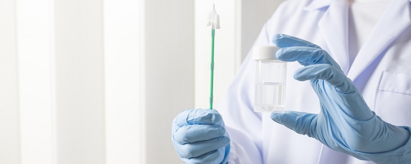 Lekarz trzyma w rękach zestaw do wykonania cytologii płynnej