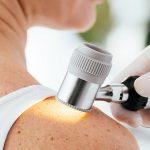 pieprzyk a czerniak - badanie dermatoskopem