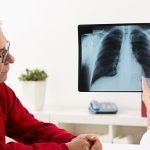 Mężczyzna i kobieta omawiają z lekarką wyniki rtg klatki piersiowej podczas diagnostyki raka płuc