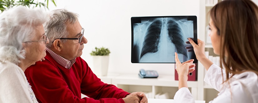 Mężczyzna i kobieta omawiają z lekarką wyniki rtg klatki piersiowej podczas diagnostyki raka płuc