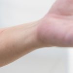 tężec - jak można się zakazić?