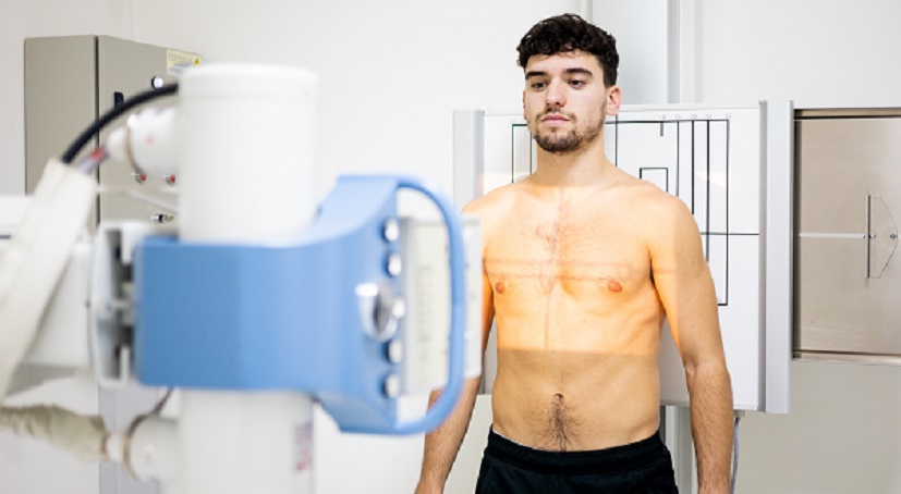 Mężczyzna podczas badania RTG klatki piersiowej wykonywanego w celu diagnozy ropnia płuc