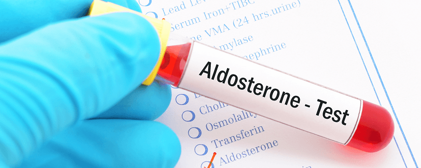 Aldosteron – normy, wskazania, przygotowanie, przebieg badania