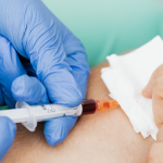 Immunoglobuliny