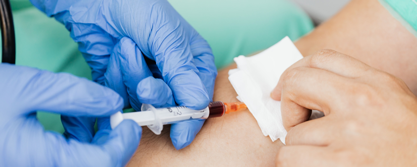 Immunoglobuliny – normy, wskazania, przygotowanie, przebieg badania