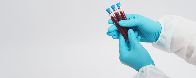 GGTP (gamma-glutamylotranspeptydaza)
