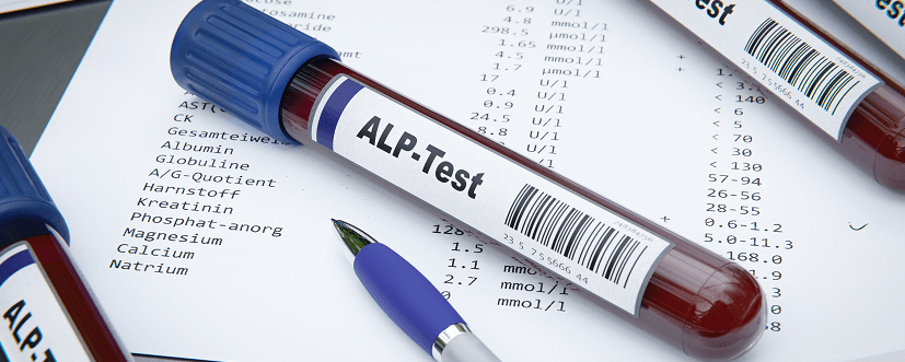 Fosfataza zasadowa (alkaliczna, ALP) – normy, wskazania, przygotowanie, przebieg badania