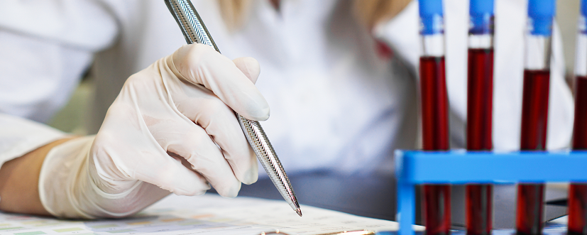 lipoproteina (a) - próbki krwi niezbędne do wykonania badania