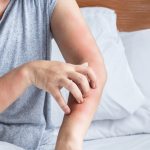 alergia na antybiotyk