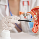 Adenomioza - ginekolog wyjaśniający na czym polega ta choroba