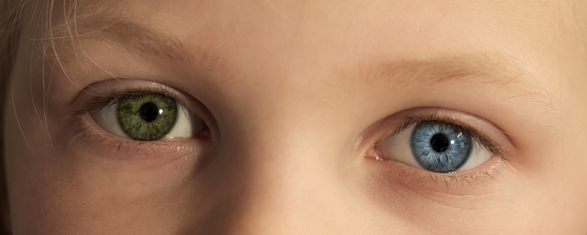 Heterochromia oczu - różnokolorowe tęczówki. Jedno oko zielone, jedno oko niebieskie