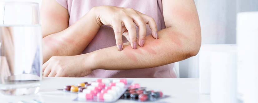 Alergia na leki