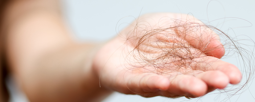 Trichotillomania – objawy, przyczyny i leczenie kompulsywnego wyrywania włosów